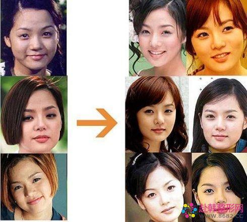 金星爆料整容女星图片视频,揭秘整容女星的真实面貌，图片视频曝光惊人真相  第3张